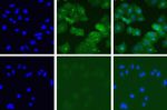 c-Met Antibody in Immunocytochemistry (ICC/IF)