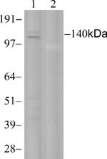 c-Met Antibody in Western Blot (WB)