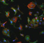 EGFR Antibody in Immunocytochemistry (ICC/IF)