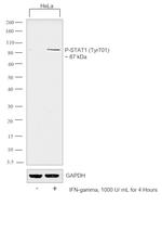 Phospho-STAT1 (Tyr701) Antibody