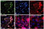 ErbB2 (HER-2) Antibody in Immunocytochemistry (ICC/IF)