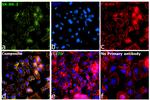 ErbB2 (HER-2) Antibody in Immunocytochemistry (ICC/IF)