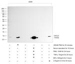 CXCL5 Antibody in Western Blot (WB)