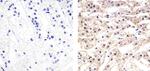 CXCL5 Antibody in Immunohistochemistry (Paraffin) (IHC (P))