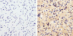 LC3B Antibody in Immunohistochemistry (Paraffin) (IHC (P))