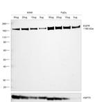 EGFR Antibody in Western Blot (WB)