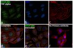 NFkB p65 Antibody