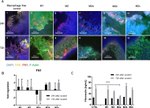 FAK Antibody in Immunohistochemistry (IHC)