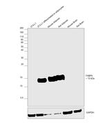 FABP4 Antibody in Western Blot (WB)