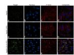 CRP Antibody in Immunocytochemistry (ICC/IF)