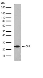 CRP Antibody in Western Blot (WB)