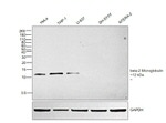 beta-2 Microglobulin Antibody