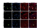 Phospho-Histone H3 (Ser10) Antibody