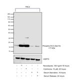 Phospho-Histone H3 (Ser10) Antibody in Western Blot (WB)