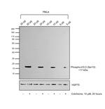 Phospho-Histone H3 (Ser10) Antibody in Western Blot (WB)