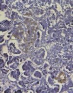 Insulin Antibody in Immunohistochemistry (IHC)