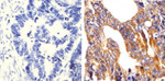 MMP3 Antibody in Immunohistochemistry (Paraffin) (IHC (P))