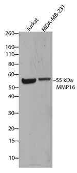 MMP16 Antibody in Western Blot (WB)