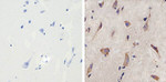 MMP16 Antibody in Immunohistochemistry (Paraffin) (IHC (P))