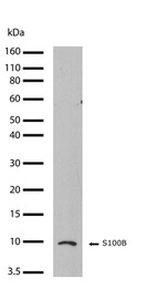 S100B Antibody in Western Blot (WB)