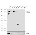 ErbB2 (HER-2) Antibody