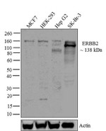 ErbB2 (HER-2) Antibody in Western Blot (WB)