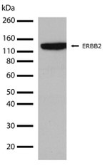 ErbB2 (HER-2) Antibody in Western Blot (WB)