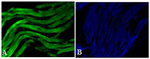 Troponin I Antibody in Immunohistochemistry (Paraffin) (IHC (P))