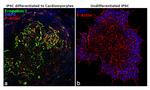 Troponin I Antibody in Immunocytochemistry (ICC/IF)