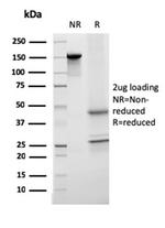 Transferrin Antibody in SDS-PAGE (SDS-PAGE)