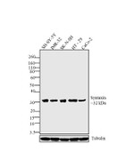 Syntaxin 6 Antibody in Western Blot (WB)