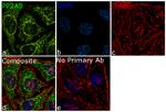 PPP2R2A Antibody in Immunocytochemistry (ICC/IF)