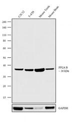 PPP2R2A Antibody in Western Blot (WB)