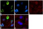 RNF20 Antibody in Immunocytochemistry (ICC/IF)