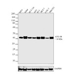 ATG4B Antibody in Western Blot (WB)