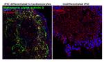 alpha Actinin 2 Antibody in Immunocytochemistry (ICC/IF)