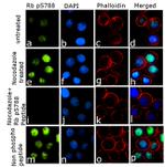 Phospho-Rb (Ser788) Antibody