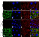 Phospho-Cytokeratin 8 (Ser432) Antibody in Immunocytochemistry (ICC/IF)