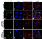 Phospho-Vimentin (Ser56) Antibody