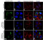 Phospho-Vimentin (Ser56) Antibody in Immunocytochemistry (ICC/IF)