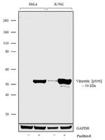 Phospho-Vimentin (Ser56) Antibody in Western Blot (WB)