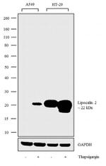 NGAL Antibody