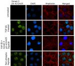 Phospho-SMAD3 (Ser423, Ser425) Antibody in Immunocytochemistry (ICC/IF)