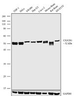 CX3CR1 Antibody in Western Blot (WB)