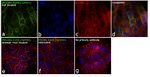 Phospho-EGFR (Tyr992) Antibody