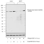 Phospho-beta Catenin (Ser552) Antibody in Western Blot (WB)