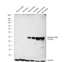 Calbindin D28K Antibody