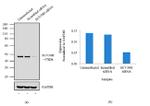 SUV39H1 Antibody in Western Blot (WB)