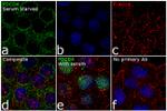 PDCD4 Antibody in Immunocytochemistry (ICC/IF)