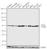 P2Y12 Antibody in Western Blot (WB)